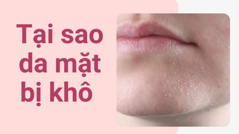 Hàng rào bảo vệ da đã bị phá hủy nghiêm trọng chưa?